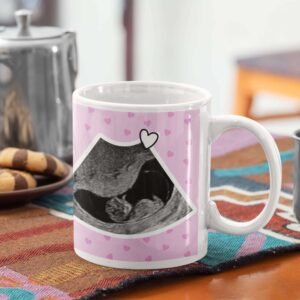 Custom Ultrasound Photo Mug - Image 4