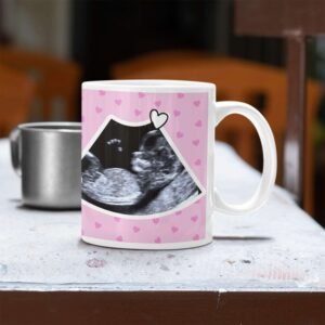 Custom Ultrasound Photo Mug - Image 3