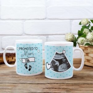 Custom Ultrasound Photo Mug - Image 7